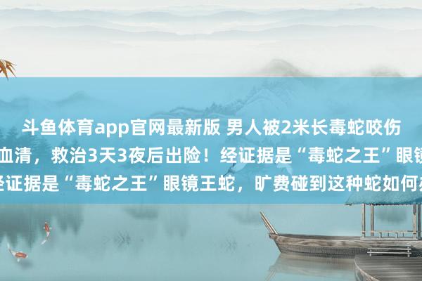 斗鱼体育app官网最新版 男人被2米长毒蛇咬伤，用了整整13支抗蛇毒血清，救治3天3夜后出险！经证据是“毒蛇之王”眼镜王蛇，旷费碰到这种蛇如何办→